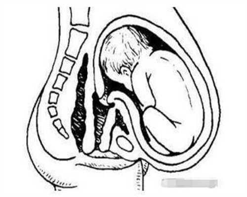 [受精卵着床出血]受精卵着床出血几天_受精卵着床出血量