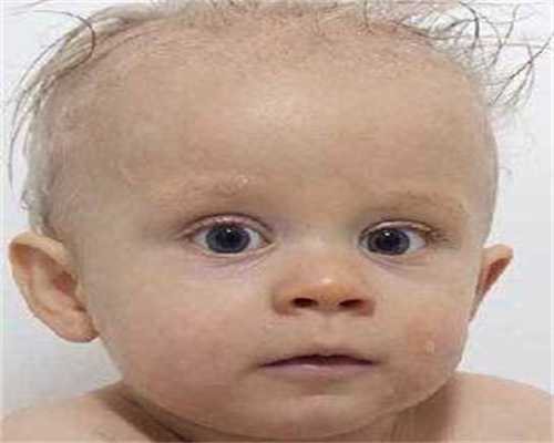 腹中广西高薪代孕志愿者缺氧的表现于症状解析，应对方法要学会这三招