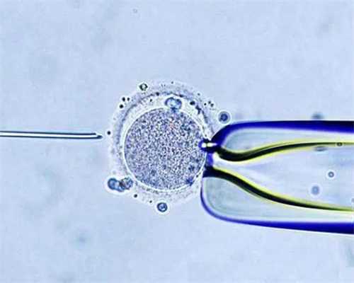 试管是什么呢~选出最有潜力的广西供卵试管生小孩种子