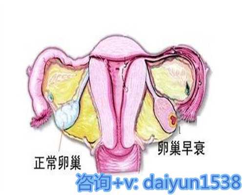 揭秘卵巢“大小”的奥秘:关乎你的生育能力