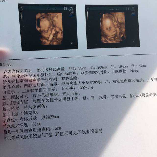 最便宜广西代妈价格表-带给你生育的新希望