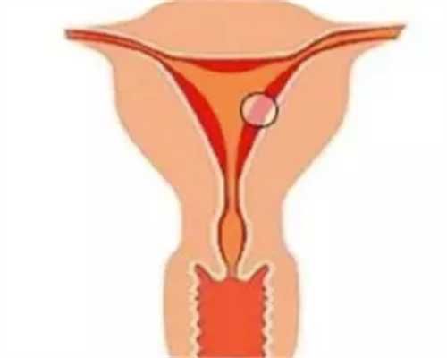 从妊娠纹看广西代孕中心什么价格性别?妊娠纹也能测出生男生生女?!