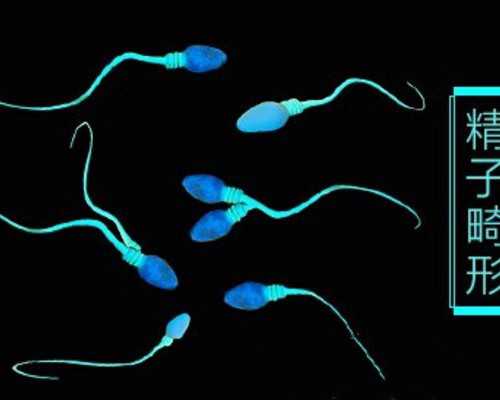 我今年30岁，AMH3.05，由于自身染色体问题，